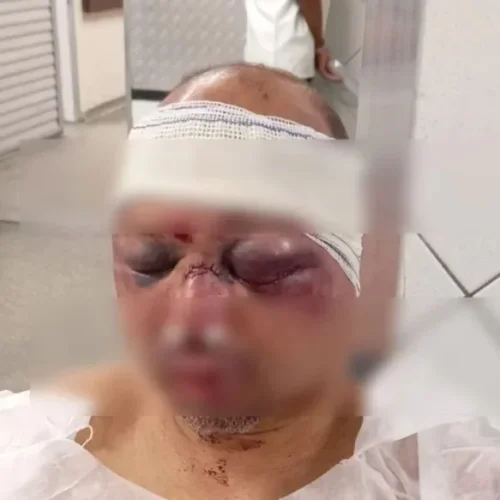 Rodoviário quase é morto por traficantes em São Marcos