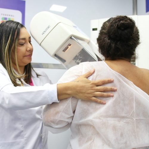 Rastreamento do câncer de mama chega às regiões de Vitória da Conquista e Brumado