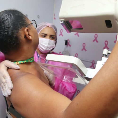 Governo da Bahia oferta 40 mil mamografias na campanha outubro rosa 2025