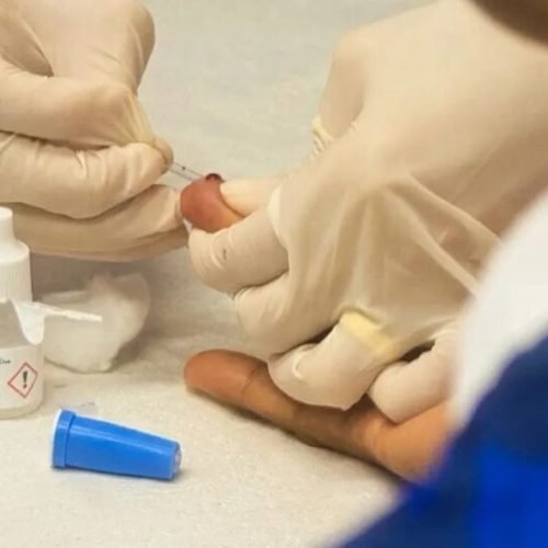 Campanha Outubro Verde leva saúde durante BAVi desta quinta (16) no Barradão